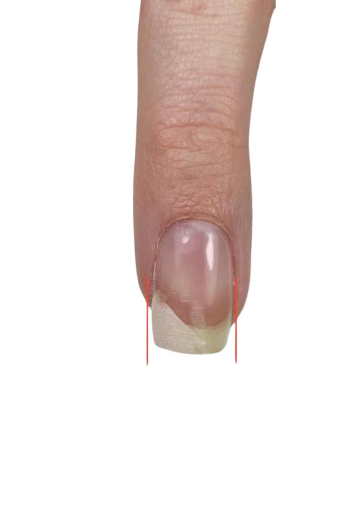 rattrapage forme acrygel