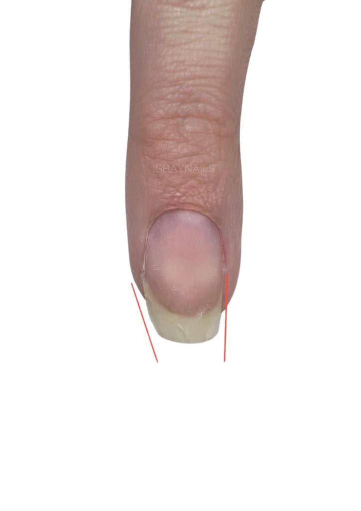 rattrapage forme acrygel